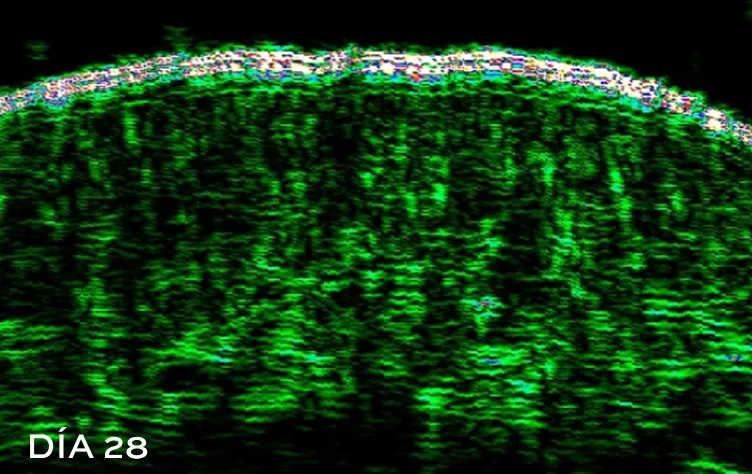 After picture of oily and acne prone skin with a clearer appearence