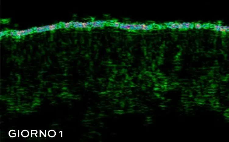 Foto de antes de la epidermis, donde se ve menos densidad