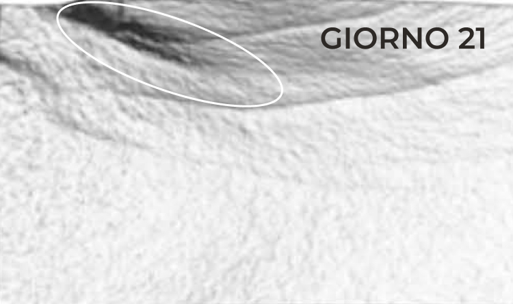 Riduzione nella zona del contorno occhi dopo