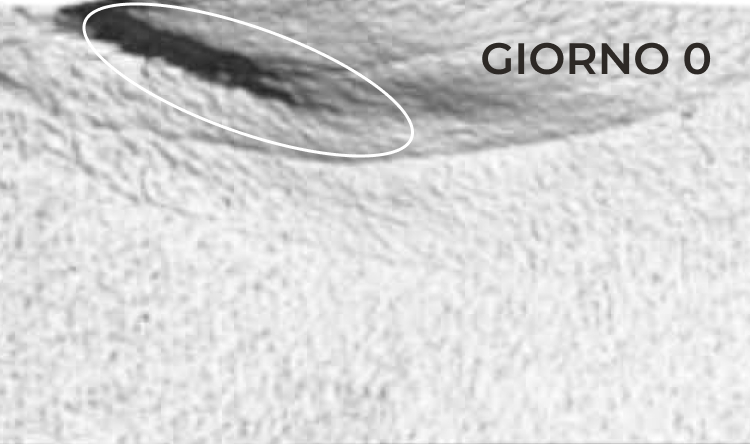 Riduzione nella zona del contorno occhi prima