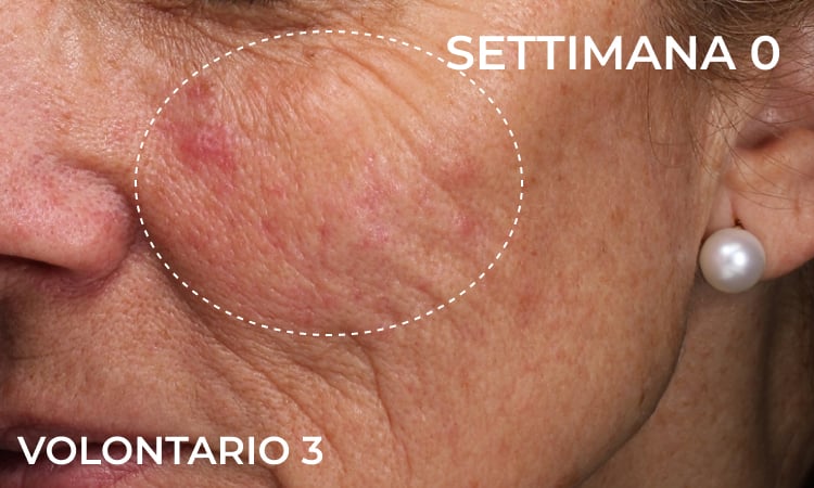 Prima dell’applicazione