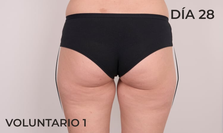 Reducción en contorno de piernas después de 28 días