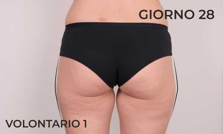 Riduzione della circonferenza delle gambe dopo 28 giorni