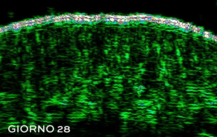 After picture of oily and acne prone skin with a clearer appearence