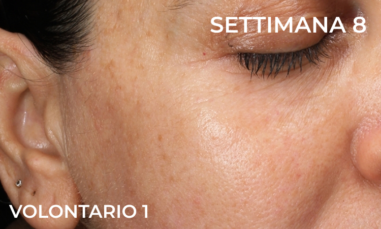 Pelle dopo 8 settimane di applicazione