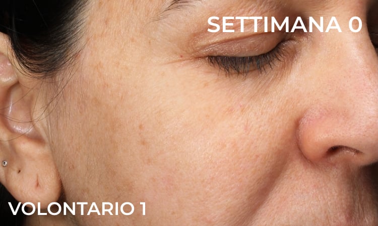 Pelle prima dell’applicazione